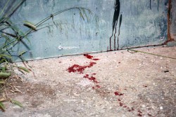 Lecce violenta, le armi tornano a sparare: 46enne ferito alla testa - Corriere Salentino