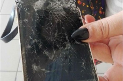 La denuncia shock su facebook: «Picchiata dal mio ex». Postate le foto delle ferite. Indaga la polizia - Corriere Salentino