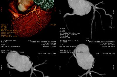 Nel Poliambulatorio Calabrese una Tac da 128 immagini al secondo: stop agli esami invasivi, precisione e tecnologia all'avanguardia - Corriere Salentino