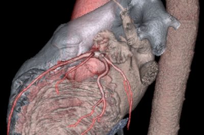 Nel Poliambulatorio Calabrese una Tac da 128 immagini al secondo: stop agli esami invasivi, precisione e tecnologia all'avanguardia - Corriere Salentino