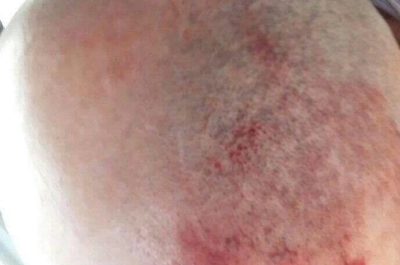 Tap, ancora tensioni davanti al cantiere: sassaiola contro polizia e vigilanza. Gli attivisti: "Violenza inaudita" - Corriere Salentino