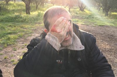 I No Tap provano a rallentare i lavori, ma vengono caricati: interviene l’ambulanza - Corriere Salentino