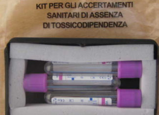 Reato di omicidio stradale, il laboratorio del «Fazzi» in prima linea per gli accertamenti sull’assenza di tossicodipendenza