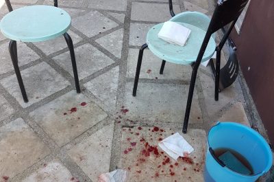 Il corso scappa e si avventa sul barboncino: il cagnolino muore, la proprietaria finisce in ospedale - Corriere Salentino