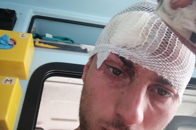 Difende un cane e gli spaccano la testa. Polizia locale: nessun segno di maltrattamento - Corriere Salentino