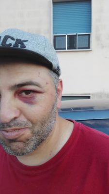 Sconcertante episodio di violenza: ragazzo disabile spedito in ospedale per pochi spiccioli - Corriere Salentino