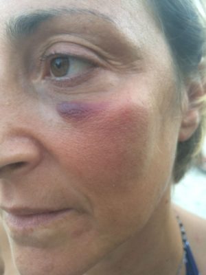 Ancora un’aggressione a un’infermiera del 118: è emergenza sulle ambulanze - Corriere Salentino
