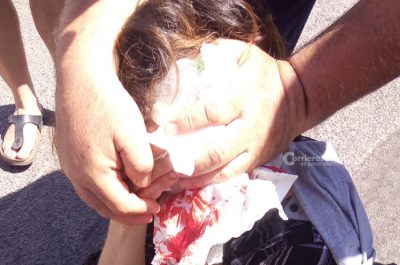 Colpita da un'auto durante un'inversione, corsa in ospedale per una 45enne leccese - Corriere Salentino