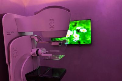 Mammografia 3 D, scoprire i tumori “invisibili": ecco come funziona e quando è necessaria la tomosintesi - Corriere Salentino