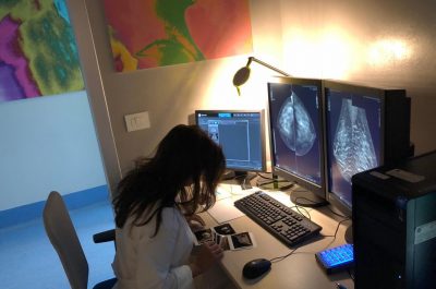 Mammografia 3 D, scoprire i tumori “invisibili": ecco come funziona e quando è necessaria la tomosintesi - Corriere Salentino