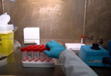virologo dell’università del salento: necessaria la sorveglianza attiva dell’hantavirus per evitare che muti Salute - Corriere Salentino