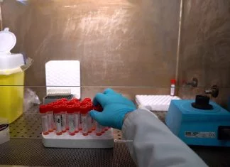 Virologo dell’Università del Salento: necessaria la sorveglianza attiva dell’hantavirus per evitare che muti