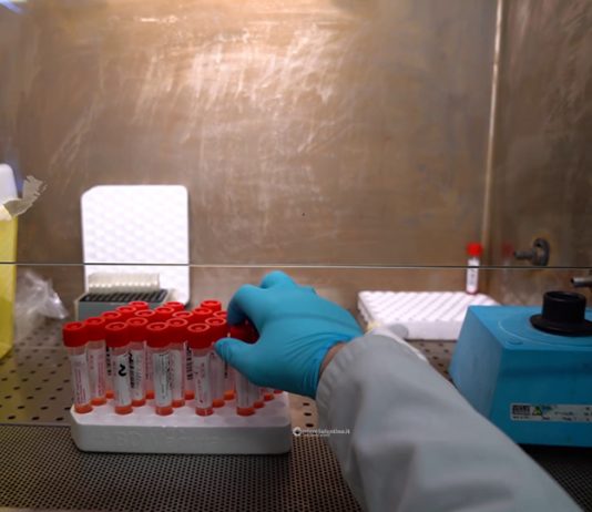 Virologo dell’Università del Salento: necessaria la sorveglianza attiva dell’hantavirus per evitare che muti