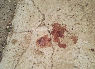 Colpita dallo specchietto di un’apecar, 69enne cade e finisce in ospedale. Conducente rintracciato dalla targa