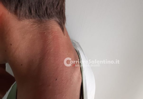 Suonano a casa e si scaglia su tre minori, poi pesta un tredicenne con l'aiuto dei figli - Corriere Salentino