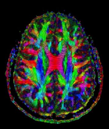 Neurostimolazione e neuromodulazione al servizio della neurologia, psichiatria e neuropsicologia nel Centro Calabrese - Corriere Salentino