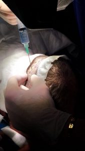 Trapianto dei capelli, il Salento si mette al passo. FUT e FUE: il dottor Sciannamea spiega le tecniche - Corriere Salentino