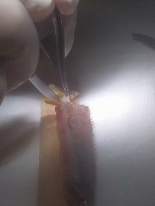 Trapianto dei capelli, il Salento si mette al passo. FUT e FUE: il dottor Sciannamea spiega le tecniche - Corriere Salentino