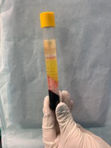 Ortobiologia: cellule staminali per combattere il dolore e riparare tessuti - Corriere Salentino