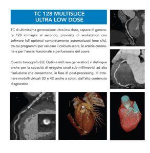 Coronaro-Tc, per un cuore senza segreti. Prevenzione, tecnologia ed esperienza: i tre requisiti per salvare tante vite - Corriere Salentino