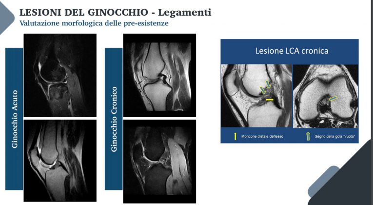 Le nuove frontiere della medicina forense. Gli infortuni ai raggi X: quando medico legale, avvocato e radiologo fanno gioco di squadra - Corriere Salentino