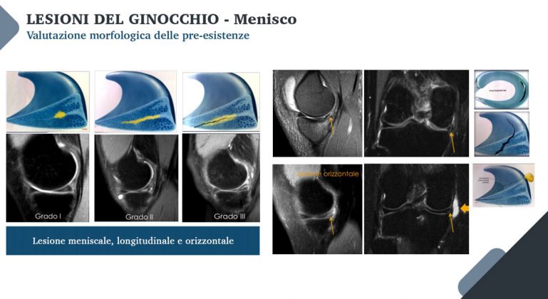Le nuove frontiere della medicina forense. Gli infortuni ai raggi X: quando medico legale, avvocato e radiologo fanno gioco di squadra - Corriere Salentino