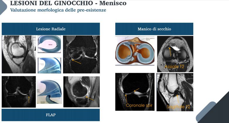 Le nuove frontiere della medicina forense. Gli infortuni ai raggi X: quando medico legale, avvocato e radiologo fanno gioco di squadra - Corriere Salentino