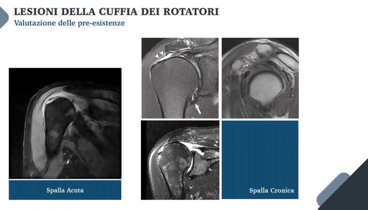 Le nuove frontiere della medicina forense. Gli infortuni ai raggi X: quando medico legale, avvocato e radiologo fanno gioco di squadra - Corriere Salentino