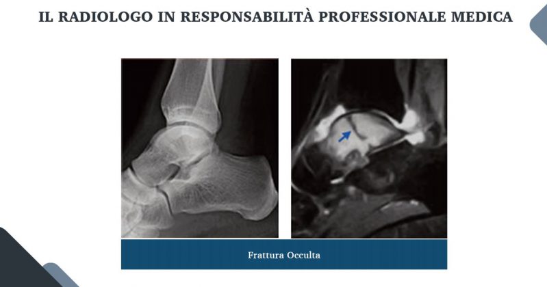 Le nuove frontiere della medicina forense. Gli infortuni ai raggi X: quando medico legale, avvocato e radiologo fanno gioco di squadra - Corriere Salentino