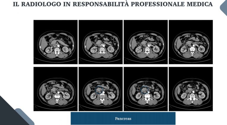 Le nuove frontiere della medicina forense. Gli infortuni ai raggi X: quando medico legale, avvocato e radiologo fanno gioco di squadra - Corriere Salentino