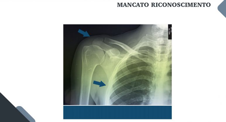Le nuove frontiere della medicina forense. Gli infortuni ai raggi X: quando medico legale, avvocato e radiologo fanno gioco di squadra - Corriere Salentino