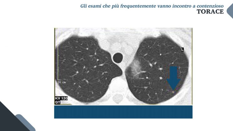 Le nuove frontiere della medicina forense. Gli infortuni ai raggi X: quando medico legale, avvocato e radiologo fanno gioco di squadra - Corriere Salentino