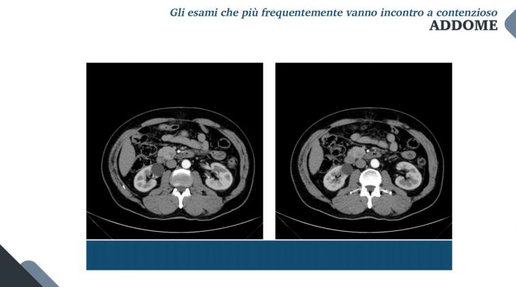 Le nuove frontiere della medicina forense. Gli infortuni ai raggi X: quando medico legale, avvocato e radiologo fanno gioco di squadra - Corriere Salentino