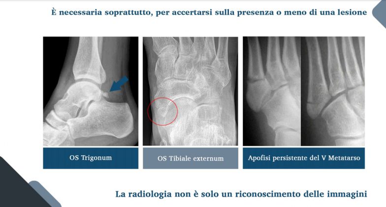 Le nuove frontiere della medicina forense. Gli infortuni ai raggi X: quando medico legale, avvocato e radiologo fanno gioco di squadra - Corriere Salentino