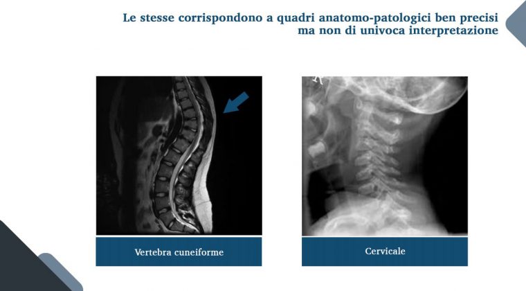 Le nuove frontiere della medicina forense. Gli infortuni ai raggi X: quando medico legale, avvocato e radiologo fanno gioco di squadra - Corriere Salentino