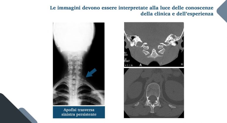 Le nuove frontiere della medicina forense. Gli infortuni ai raggi X: quando medico legale, avvocato e radiologo fanno gioco di squadra - Corriere Salentino
