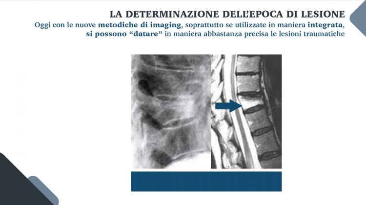 Le nuove frontiere della medicina forense. Gli infortuni ai raggi X: quando medico legale, avvocato e radiologo fanno gioco di squadra - Corriere Salentino