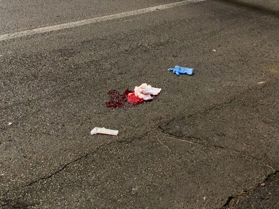 Travolto da un suv sulla circonvallazione: in ospedale con codice rosso - Corriere Salentino