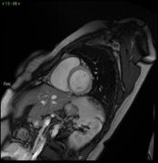 Le tecnologie avanzate che salvano la vita. Cardio RM senza e con contrasto: studiare le strutture cardiache con grande precisione - Corriere Salentino