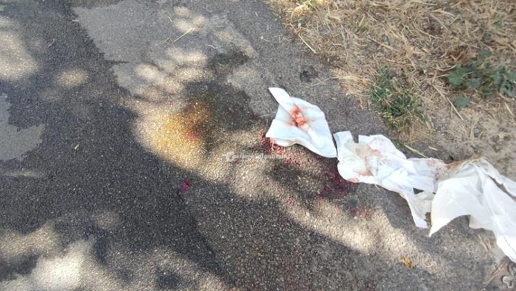 Paura per strada, pittbull aggredisce 32enne e il suo cagnolino: azzannata alla gamba - Corriere Salentino