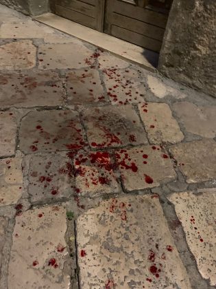 La lite in strada degenera, i violenti scappano prima dell'arrivo della polizia: per terra sangue e bottiglie rotte - Corriere Salentino