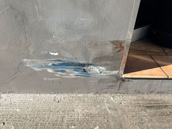 Un’auto lo travolge mentre attraversa la strada, per salvarlo i medici gli amputano mezza gamba: gravissimo un 17enne - Corriere Salentino