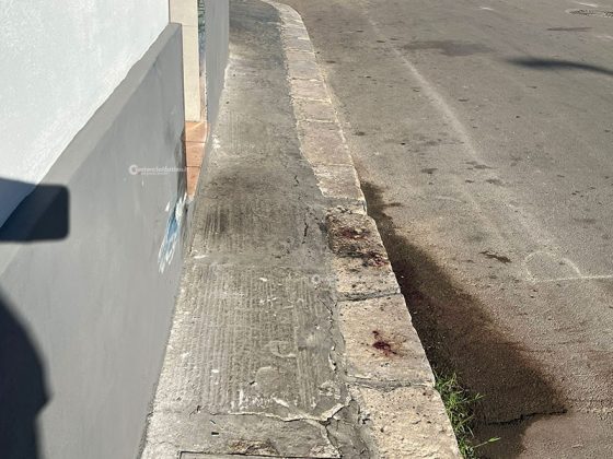 Un’auto lo travolge mentre attraversa la strada, per salvarlo i medici gli amputano mezza gamba: gravissimo un 17enne - Corriere Salentino