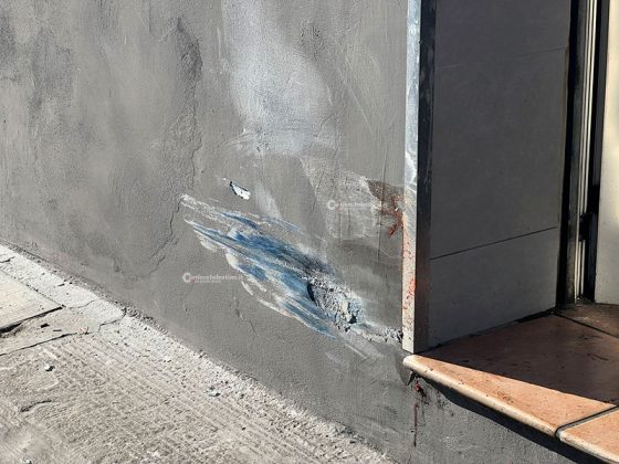 Un’auto lo travolge mentre attraversa la strada, per salvarlo i medici gli amputano mezza gamba: gravissimo un 17enne - Corriere Salentino