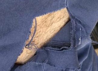 Il pitbull di un senzatetto aggredisce passante, Guido: “La colpa non è loro, ma di chi non bada a loro”