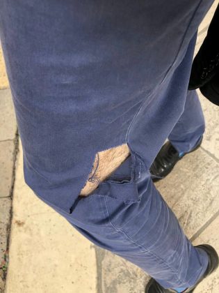 Il pitbull di un senzatetto aggredisce passante, Guido: "La colpa non è loro, ma di chi non bada a loro" - Corriere Salentino