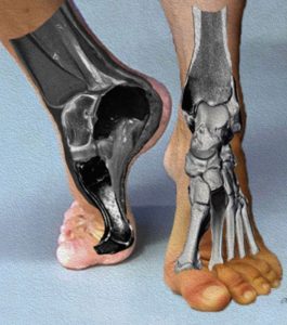 La risonanza magnetica settoriale “a cielo aperto”per esami in posizione di sintomo nel Centro Calabrese di Cavallino: un grande passo in avanti nella tecnologia applicata allo sport - Corriere Salentino