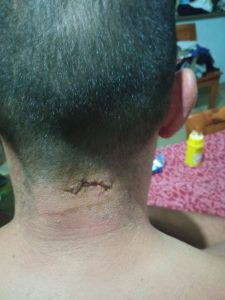 Rapper aggredisce presunto violentatore di una sua fan dopo concerto: a processo con altri due - Corriere Salentino