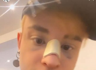 Studente salentino aggredito in un locale: “Picchiato per aver baciato un amico. Aiutatemi a trovarli”