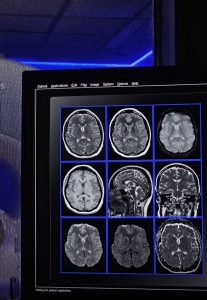 L’innovativa procedura della risonanza magnetica in sedazione cosciente nel Centro Calabrese di Cavallino, con macchinari“aperti” e di ultima generazione - Corriere Salentino